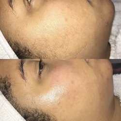 Perfect Lash Studio - Dermaplaning facial