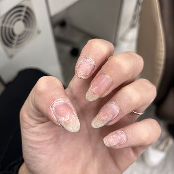 LV Nail Spa - broken pointer nail - Nail Salons Near Me - Andover, Massachusetts
