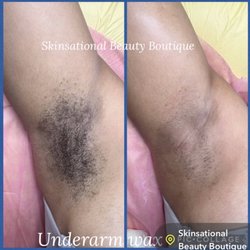 Skinsational Beauty Boutique - Before and after underarm wax