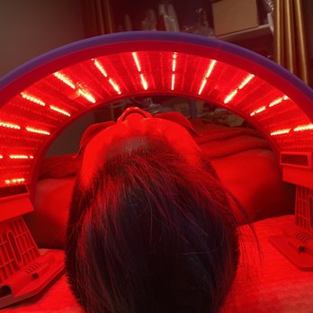 Source - Red light therapy , Post-microderma - Acupuncture Near Me - San Diego, California Source - Red light therapy , Post-microderma - Acupuncture Near Me - San Diego, California