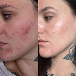 My progress! I still have a bit of progress to go, but I couldn't be happier My progress! I still have a bit of progress to go, but I couldn't be happier