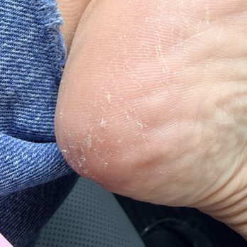 Cindy Nails Spa - Worse than when I went in - Nail Salons Near Me - Chatsworth, California