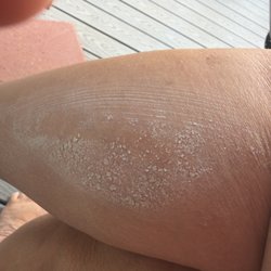 What ever she used didn't soak in or was off.
