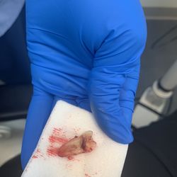 Great Expressions Dental Centers Eagles Landing Ortho - My tooth