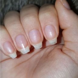 My natural nails after 1 year of GelX
