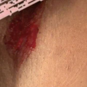 European Wax Center - Bleeding uncontrollably, excruciating pain - Waxing Near Me - Lutz, Florida