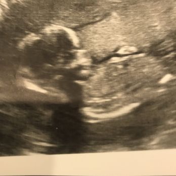 Baby Bump Studios - Diagnostic Imaging Near Me - Ontario, California Baby Bump Studios - Diagnostic Imaging Near Me - Ontario, California