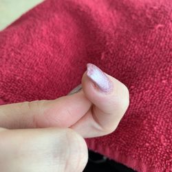 My finger that was filed raw