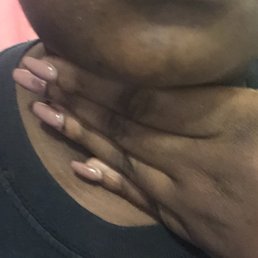 Updated scar Updated scar