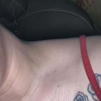 Jade Massage - Bruised on right. She pulled a nerve. And I told her to stop and she kept going - Massage Near Me - Fresno, California