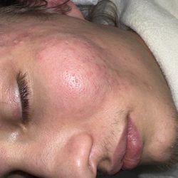 Mila Beauty - After