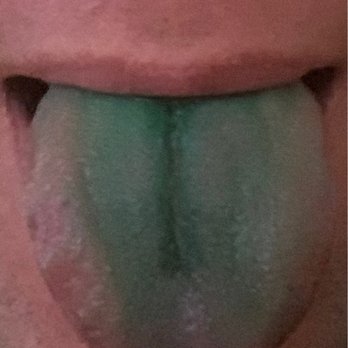 Oree - my tongue after raspberry tart and green cream on top of the tart! color stays for couple hours((( not sure if it healthy - Patisserie/Cake Shop Near Me - London, XGL Oree - my tongue after raspberry tart and green cream on top of the tart! color stays for couple hours((( not sure if it healthy - Patisserie/Cake Shop Near Me - London, XGL