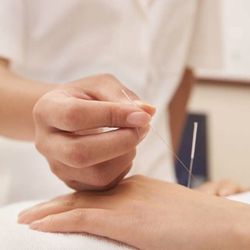Fei Yang Acupuncture