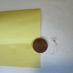 Park Centre Animal Hospital - This is the suture - including a big knot - that we pulled out of our cat more than a month after her surgery.