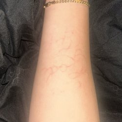 StayFresh Tattoos - 5months later would not recommend I have have tattoos and this one did not heal like the rest. they were hella rude and unprofessional