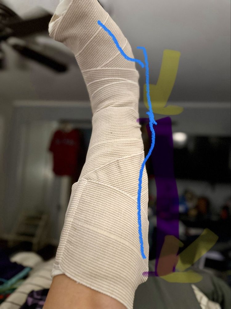 Baylor Orthopedic & Spine Hospital at Arlington - patient advocate in Arlington, TX