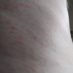 ZAP Pest Control - 1/2 hour of layingh on the couch they said they sprayed!