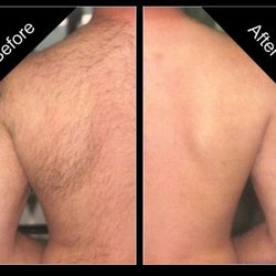 CLEAN SLATE SKIN STUDIO - Body waxing services for men too!
