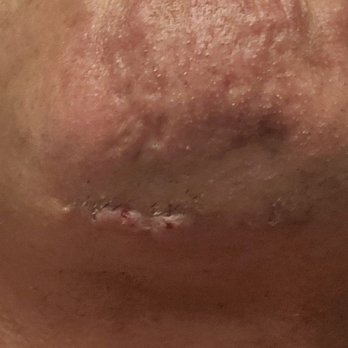 Beauty Land Plastic Surgery - Plastic Surgeons Near Me - Miami, Florida Beauty Land Plastic Surgery - Plastic Surgeons Near Me - Miami, Florida