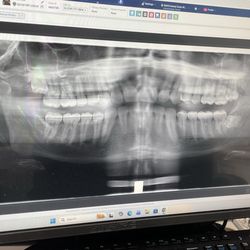 Dental Suite - They explained to me in detail what issues I may have