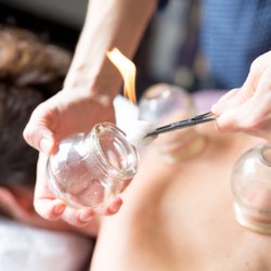 Venn Acupuncture - Fire cupping assists muscle repair, relieves toxins, reduces inflammation, Increases Immunity, and Boosts Lung function.