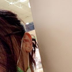 Earring's World - My most recent snake bites in the orbital region