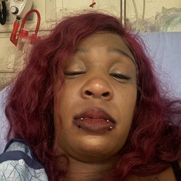 Allergic reaction  Didn't care about my health they all laughed at me