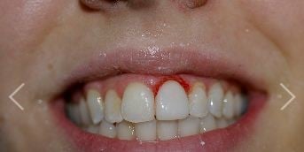 James Glennon Jr, DDS - Glennon Dental