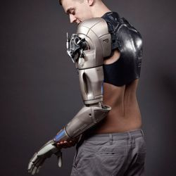 Mobility Prosthetics