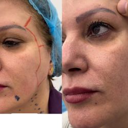 Sheis Beauty Medical Spa