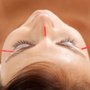 Yin Rising Acupuncture