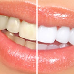 Ellet Dental