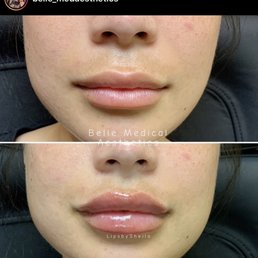 Lips