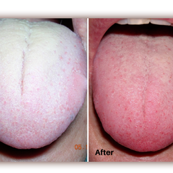 HH Wellness - Before and After results with Wellness services