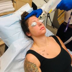 WJ3 Med Health & Beauty Center - Alma Laser Tattoo Removal #TattooRemovalyucaipa #almalaseryucaipa #LaserTattooRemovalyucaipa #FreshStartyucaipa #SkincareGoalsyucaipa