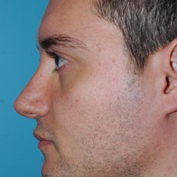 Davis Richard MD - Center For Facial Restoration - Simulation of Dr. Richard Davis.
