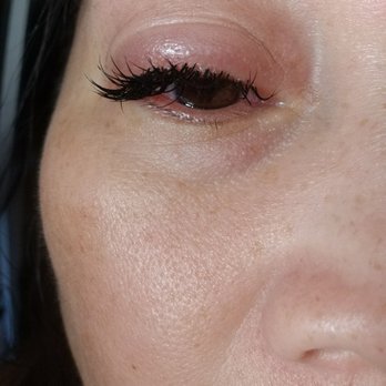Beauty Lashes - Swollen and painful - Eyelash Service Near Me - Camarillo, California Beauty Lashes - Swollen and painful - Eyelash Service Near Me - Camarillo, California