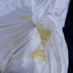 ArchCare at Terence Cardinal Cooke Health Care Center - Body fluids with urine!