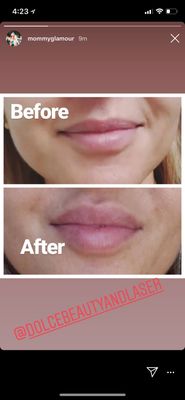 Dolce Beauty and Laser