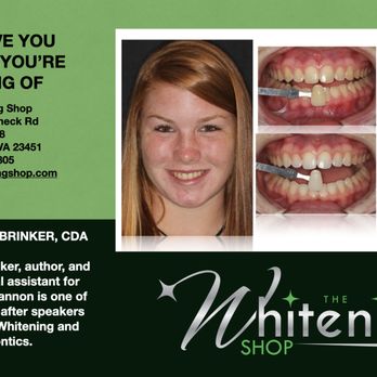 The Whitening Shop - We love Teens and always looking to make them smile! - Teeth Whitening Near Me - Virginia Beach, Virginia The Whitening Shop - We love Teens and always looking to make them smile! - Teeth Whitening Near Me - Virginia Beach, Virginia