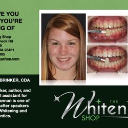 The Whitening Shop - We love Teens and always looking to make them smile!