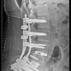 You can see a small left over screw in the photo. Couldn't get that one out.