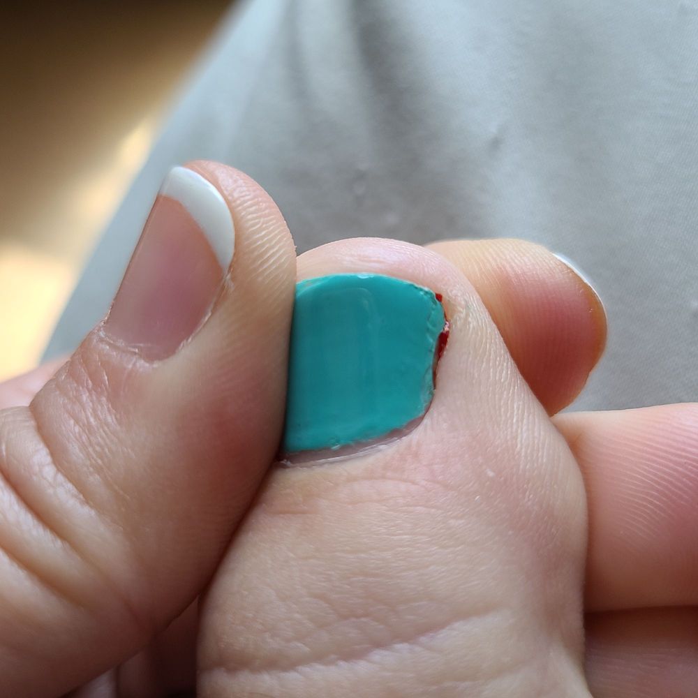 Rose Nailspot - Blood from my cuticle. It hurts like a bruise all around the nail... - Nail Salons Near Me - Katy, Texas Rose Nailspot - Blood from my cuticle. It hurts like a bruise all around the nail... - Nail Salons Near Me - Katy, Texas