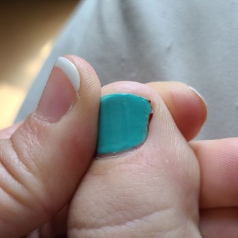 Rose Nailspot - Blood from my cuticle. It hurts like a bruise all around the nail... - Nail Salons Near Me - Katy, Texas Rose Nailspot - Blood from my cuticle. It hurts like a bruise all around the nail... - Nail Salons Near Me - Katy, Texas