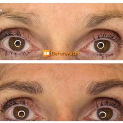 The Cosmetic Center Of Permanent Make Up - Before and after 1st visit