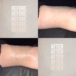 The Tox Scottsdale - So much relief no more bloat