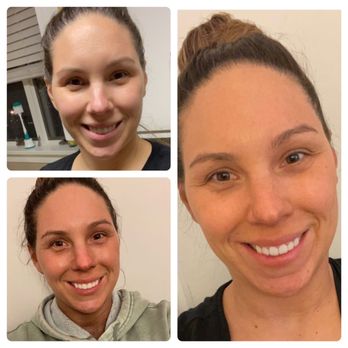 Glo On The Go - Before, Immediately after, next day - Spray Tanning Near Me - Ardmore , Pennsylvania Glo On The Go - Before, Immediately after, next day - Spray Tanning Near Me - Ardmore , Pennsylvania