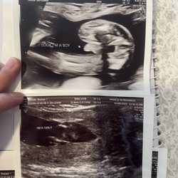 Miracle In Progress 3D4D Ultrasound Studio - LV - Ultrasound photos. It supposed to be 13 weeks idk why it says 12weeks (bottom) 20 weeks (top)