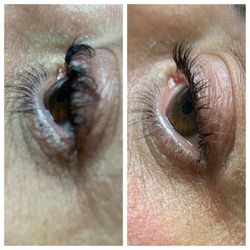 Arch 2 Arch - Her work (left pic) , and the corrected eye after a reversal (right).