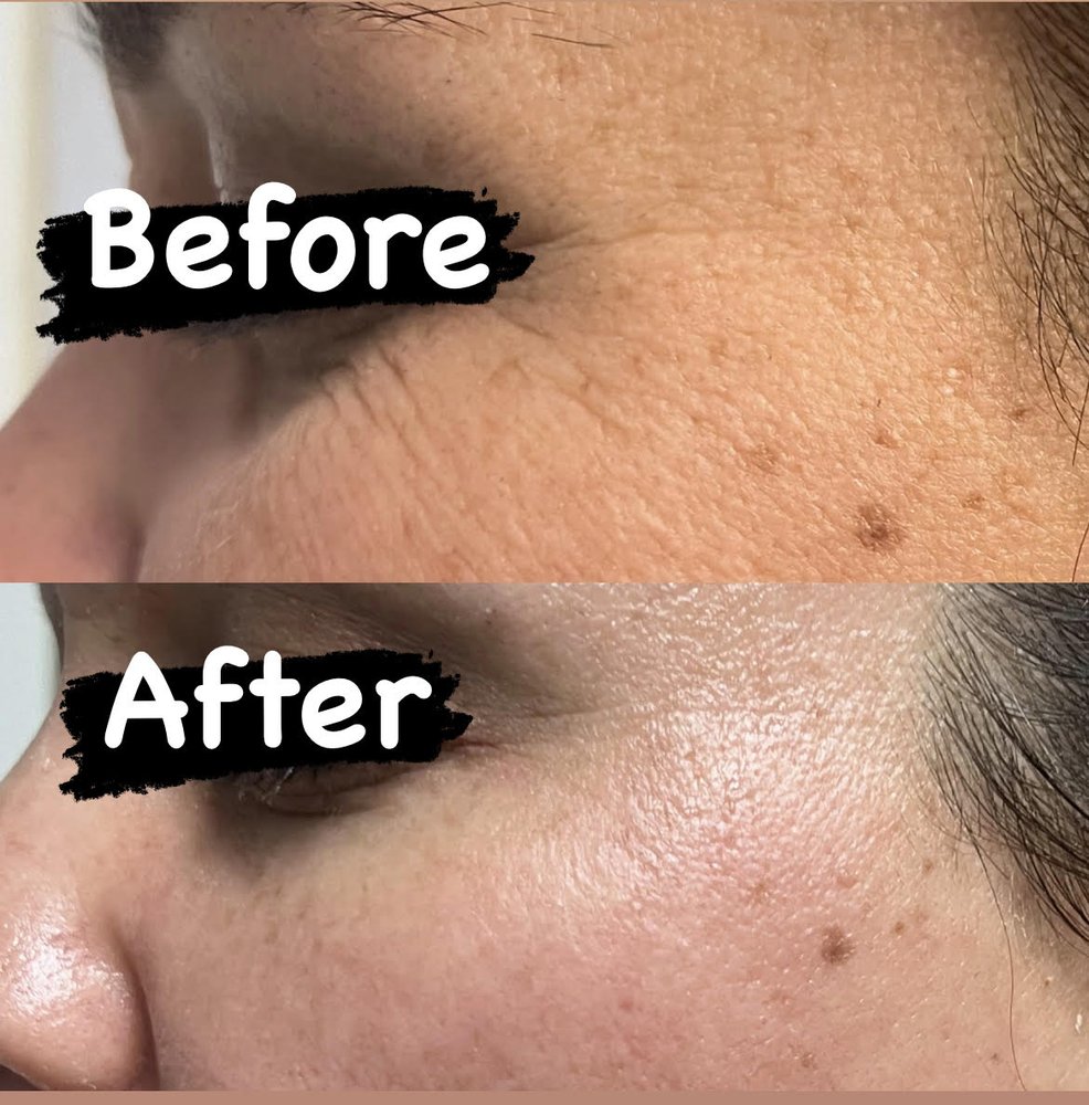 The Perfect Skin Logo